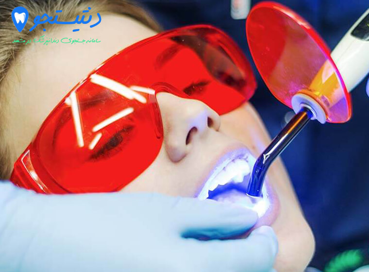 لیزر دندانپزشکی چیست | فواید لیزر دنداشکی
