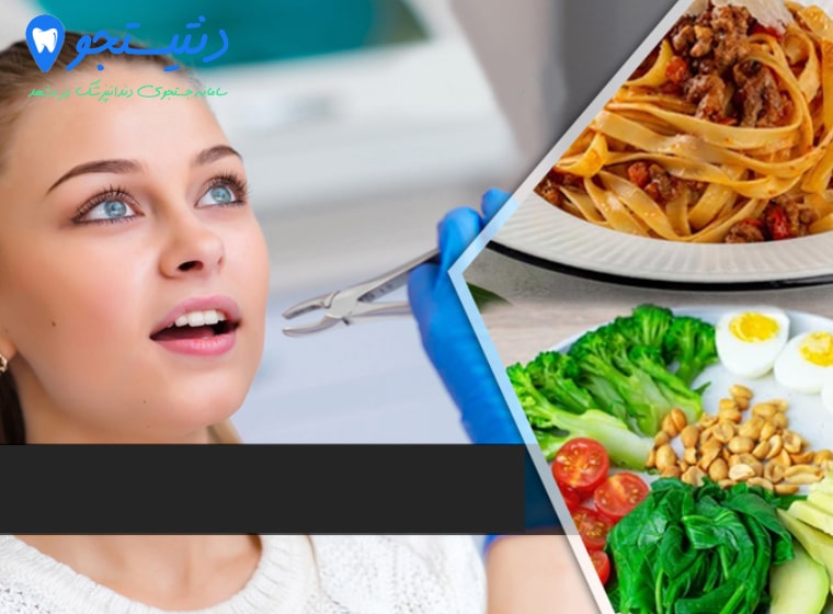 غذا خوردن بعد از کشیدن دندان | زمان غذا خوردن بعد از کشیدن دندان