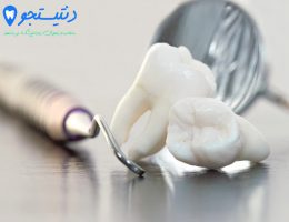 زمان بهبودی جراحی دندان عقل